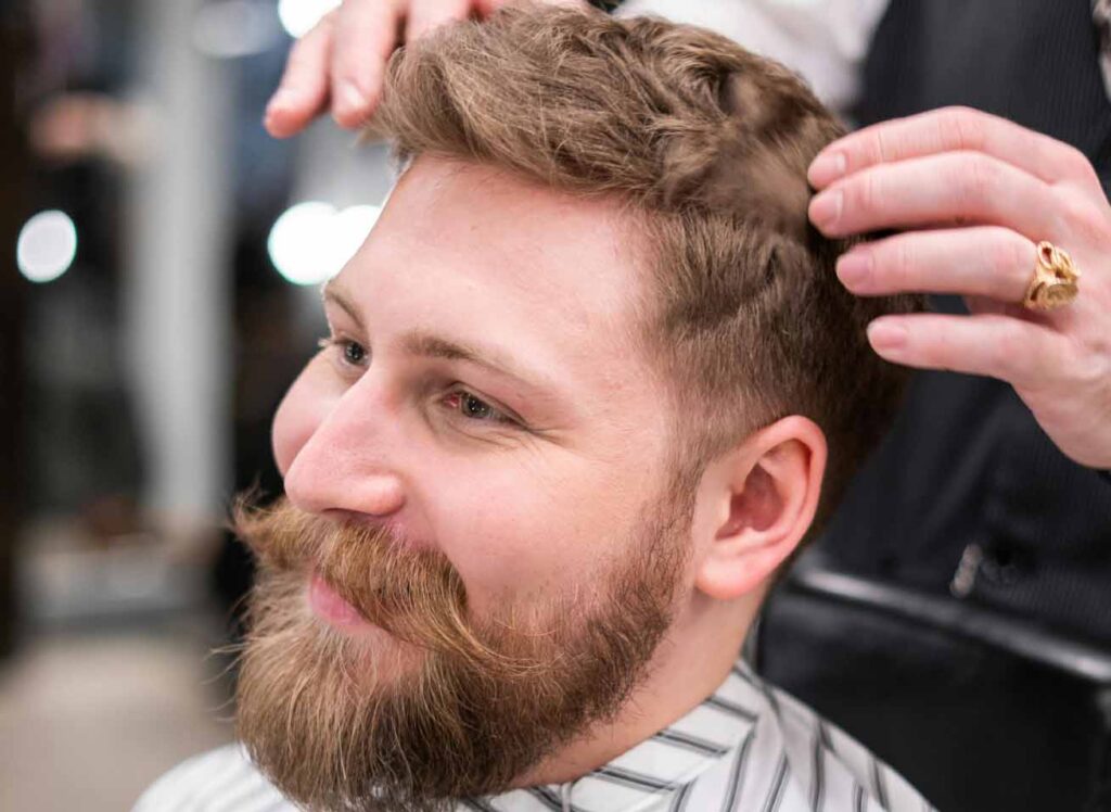 FUE Hair Transplants Look Natural